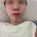 필바이오 | 울산 피부관리 • 뷰티블레스 바이오리필(슈렉필) 물방울 관리 후기
