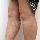 강남세종한의원 | 성인 아토피 한의원? &#39;이런&#39; 곳 추천합니다.