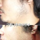 춘천왁싱에스샵왁싱 이미지