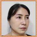 거상 | 이마거상 후기 통해 확인할 수 있는 관리 지침