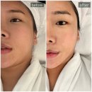 모현동-47 | 익산 모현동 피부관리 &lt;에르떼&gt; / 여름철 피지 유수분 화이트토닝