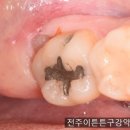 이튼튼구강악안면외과치과의원 네이버블로그