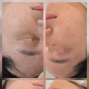 The 예쁜 피부
