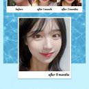 한코티에스