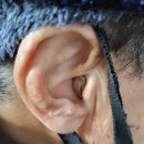 부안보청기 네이버블로그
