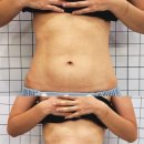 태크니끄 이미지