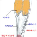 발 통증과 재활②﻿아킬레스건 손상(Achilles tendon injury) 이미지