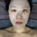 군산푸른솔초등학교 | 군산 피부관리 보금뷰티ㅣ피코레이저특수앰플 관리 1회차 후기