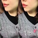 봄눈피우다의원 이미지