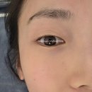 오룡약국 | [남악. 무안피부관리] 이솔에스테틱_플라즈마 수분충전!