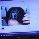 롯데프레시 안산고잔점 | 안산탈모 안산두피관리 닥터모락 안산고잔점 솔직 후기