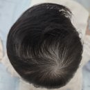 주식회사 한국안면성장교정센터 | [오쏘코리아] 두상 교정기(헬멧) 착용 결정기&첫 착용 후기(추천인 코드 22/5#622)