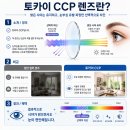 토카이 CCP, 마르쿠스티 - 녹내장 수술 후 눈부심 안경 후기