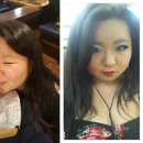 노원연세성형외과 | <<노원 성형외과 상담 투어>> 광고 1도 없는 생생 터지는 후기 ***스압 주의***