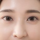 최동익성형외과 네이버블로그
