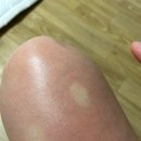 예소라트 | 닥터하이365 부기부기(Boogi Boogi) 내돈내산 구매후기(예소라트 공구템)