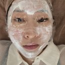 아그네스 | 포텐자 아그네스 후기 / 벨로의원 다녀왔어요!