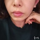 원명빌딩 | 40대 쳐짐 관리 : &#34;얀클리닉 티타늄리프팅&#34; 후기, 듀얼티타늄 가격