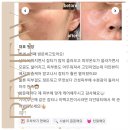 더안헬스케어 | [진주 피부관리] 작은 얼굴&amp;동안 윤곽&amp;스킨케어 고객님 찐 후기 더안 뷰티 진주점