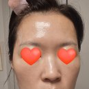 에스바이에스 | cell by cell 셀바이셀 피부과용 에스데틱용 앰플, 크림 고민되는 후기