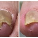 미엘네일 이미지