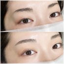 누가의료기부천중동점 | 부천중동눈썹문신 비율을 고려한 디자인