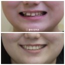 서울더웃는치과의원 이미지