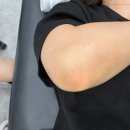 은미인뷰티케어 | 홍대멜라닌케어 은뷰티 팔꿈치미백 홍대미백관리 후기