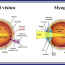 안경닥터 이미지