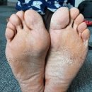 손태석 발가락운동용구 이미지