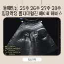 강 동물병원(산업동물출장진료 동물병원) | 증상 임산부당뇨 임당검사 임당재검 임당확정 의정부을지대병원 임산부공복혈당 임산부당관리 베이비페이스