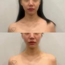 샵대패공장 | 천안 온스에스테틱본점 경락 윤곽관리 비대칭개선 15회차 내돈내산 후기 짝꿍할인 가능 !🍀