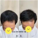 평택 이복순 원장 다윤헤어 탈모관리 고수 찐후기