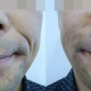 웰빙비뇨기과 네이버블로그