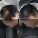 키키브라더스 이미지