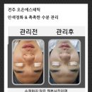 전주남자피부관리 후기｜남성 고객님들은 왜 피부관리를 받을까요?
