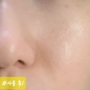 피부앤인체바란스