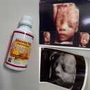 인생네컷 | 산본제일병원 임당검사 5D입체초음파 인생네컷 후기