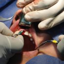 이건치과기공소 이미지