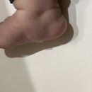 주식회사 민들레 | 멍게육아