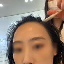 김정문알로에 구로지점 | 구로탈모관리는 여기서! 탑스칼프구로디지털점에서 두피관리 솔직후기