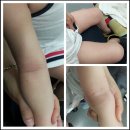 온새미로 아토 | 아토피 치유로션