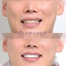 세라치과기공소 이미지