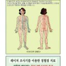 라파전위 이미지