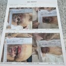 대안경로당 | 제보&gt; 요양병원에서의 욕창은 의료사고로 김제 가족사랑요양병원과 김천요양병원의 경우- 1톤 트레일러...