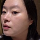 영메디케어