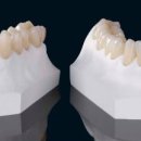 광테크치과기공소 이미지