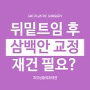 뒤밑트임 후 삼백안 교정하는 방법 이미지