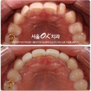 OK치과기공소 이미지