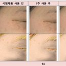 바이홉 네이버블로그